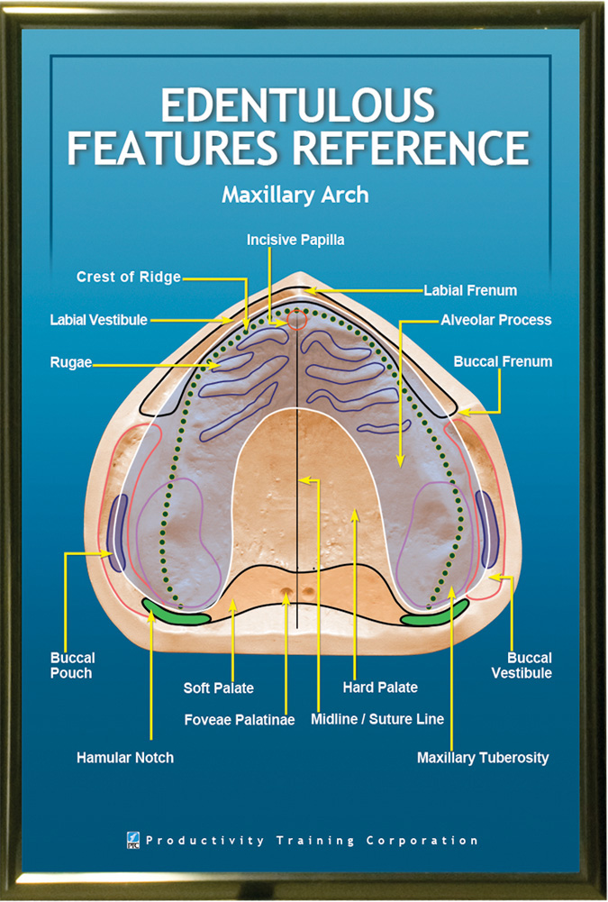 PTC-Poster-Maxillary-Arch-Edentulous-Features-Unframed