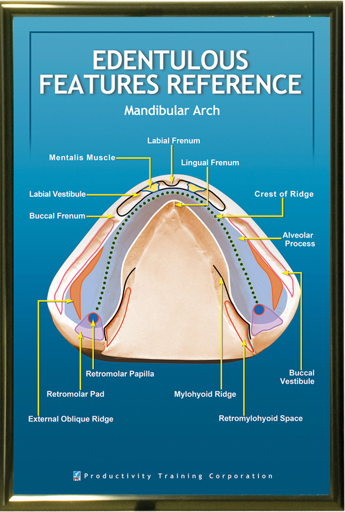 PTC-Poster-Mandibular-Arch-Edentulous-Features-Unframed